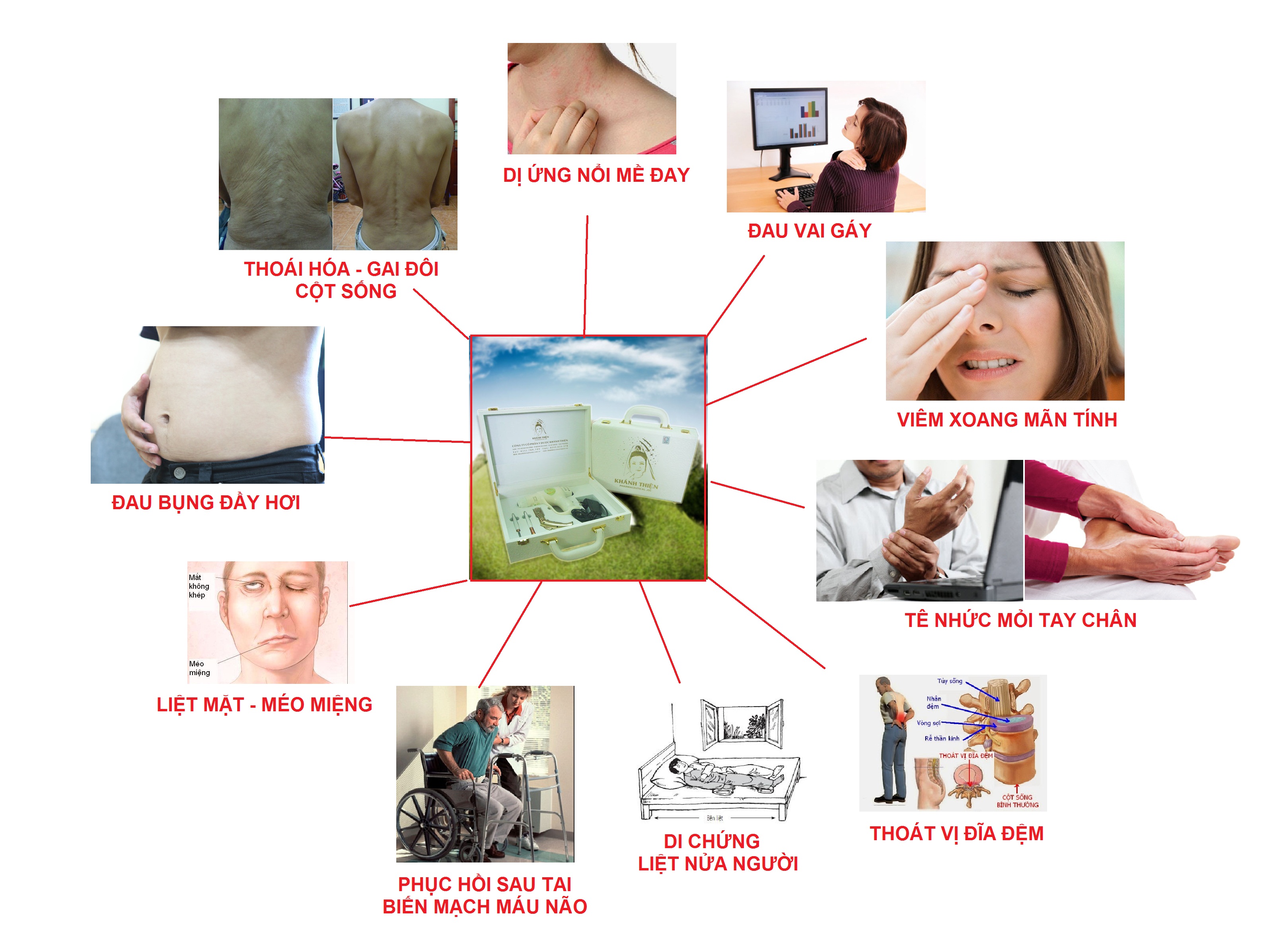 BỆNH GÌ CHÂM CỨU CHỮA ĐƯỢC MÁY CỨU NGẢI CHỮA ĐƯỢC